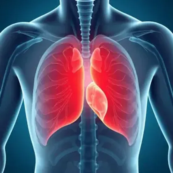 Angina sintomas e tratamento: sinais, causas e quando procurar atendimento