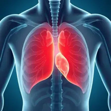 Angina sintomas e tratamento: sinais, causas e quando procurar atendimento