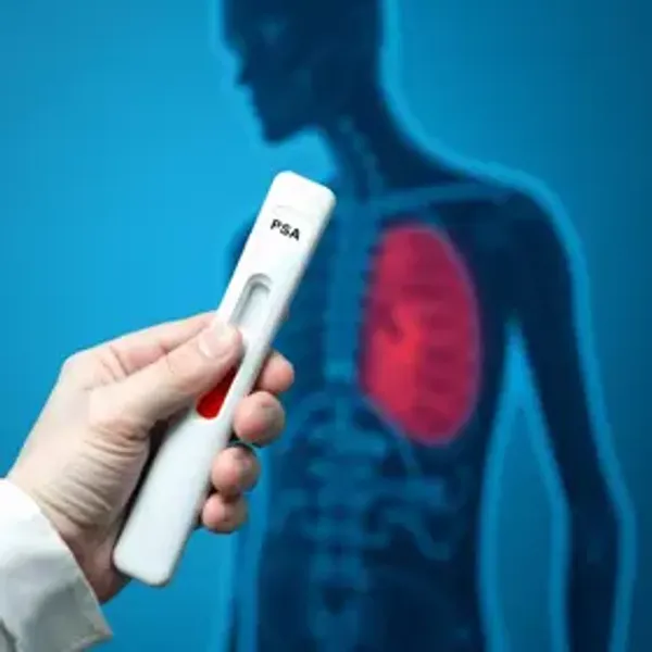PSA alto o que significa: significado, causas relacionadas e quando investigar
