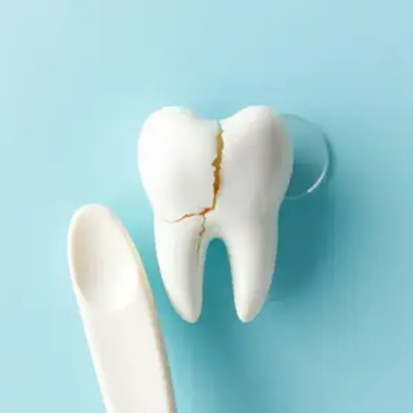 Dente quebrado o que fazer: passo a passo seguro e cuidados importantes